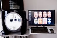 VISIA Complexion Analysis System for UV Spots Brown Spots Red Areas PORPHYRINS WRINKLES TEXTURE PORES SPOTS Analysis