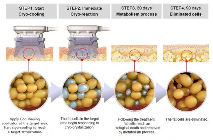 2017 nuevo Cryotherapy de congelación gordo que adelgaza la máquina 4 en 1